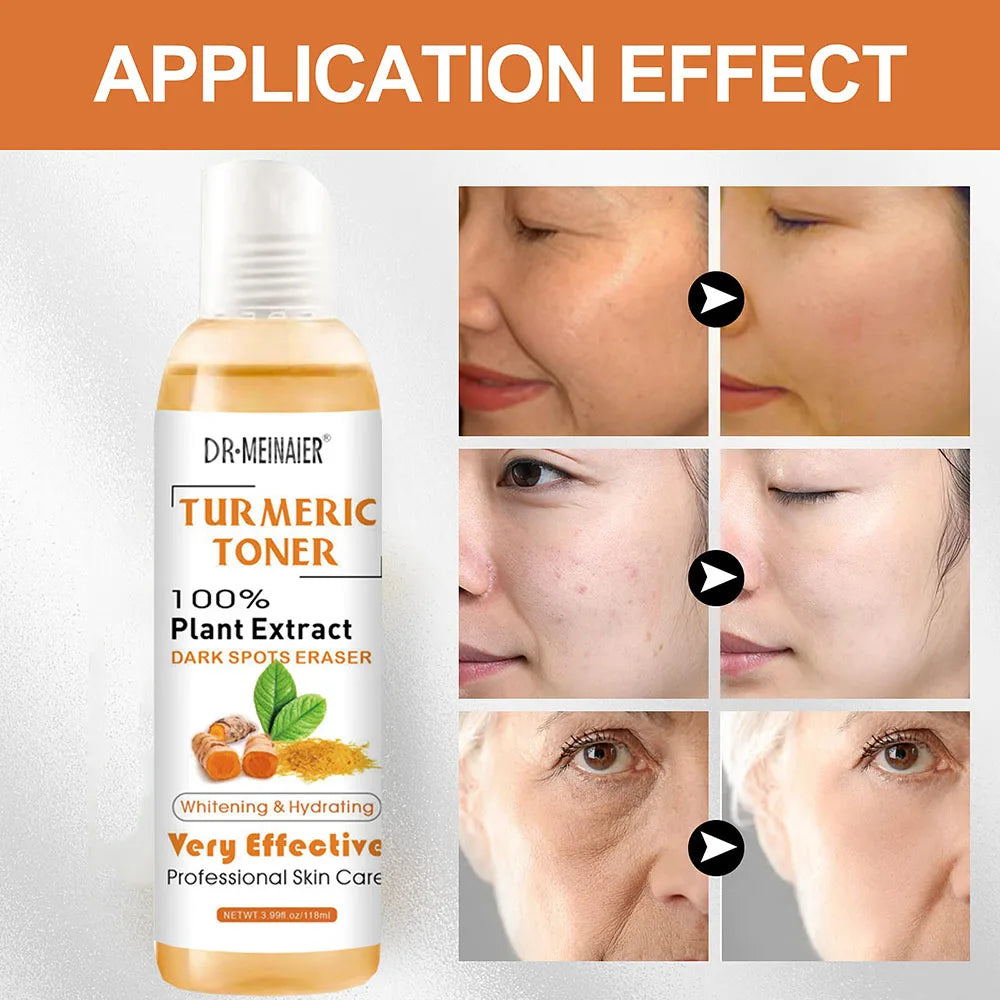 "Set of 2 Turmeric Dark Spot Corrector Toners for Fading Blemishes, Acne, and Dark Spots on Dark Skin"